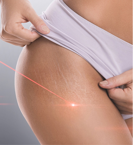 Elite SkinMD - Laser and Light Therapy - Laser skin resurfacing Warren NJ - intense pulsed light Warren NJ - laser hair removal Warren NJ  - Acne Laser Treatment Warren NJ  - Photodynamic therapy Warren NJ  - IPL Warren NJ 