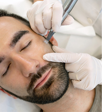 Elite SkinMD - Radiofrequency Microneedling Warren, NJ - Anti-Aging Procedures - Radiofrequency Microneedling near me - dermatologist near me - skin care products - skin care treatment near me