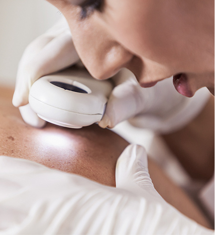 Elite SkinMD - Skin Cancer Diagnosis - Skin Cancer Treatment near me - Mohs Surgeon Warren, NJ - Skin Cancer Treatment Warren, NJ - Mohs micrographic surgery - Mohs Surgeon near me -  basal cell carcinoma - squamous cell carcinoma 